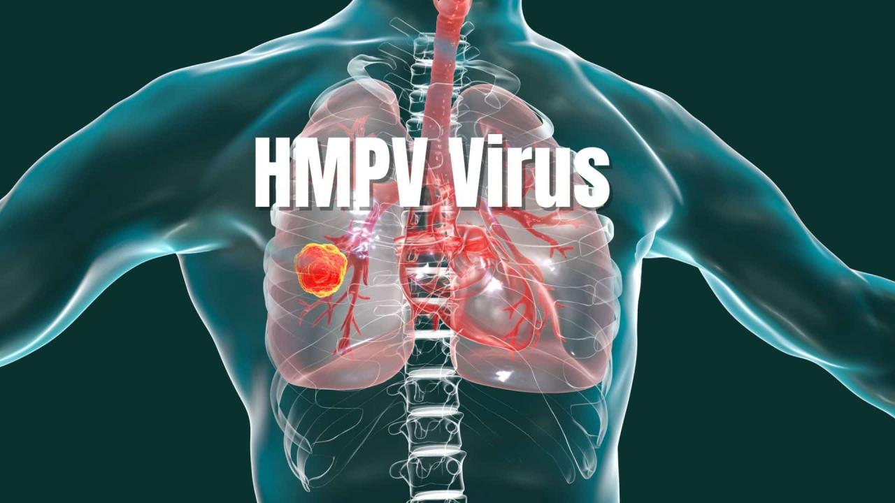 China Calls HMPV Outbreak 'Winter Occurrence', India Says 'Don't